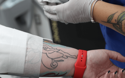 Tattoo Removal in Washington DC: What You Need to Know?