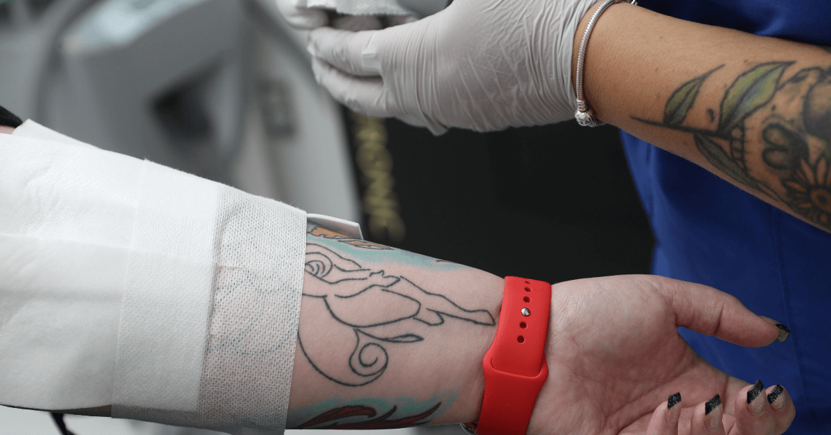 Zapatat Tattoo Removal in weeks Transformation Videos